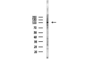 anti-phosphodiesterase 11A (PDE11A) (Internal Region) antibody