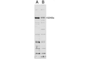 Image no. 2 for anti-SECIS Binding Protein 2 (SECISBP2) (Internal Region) antibody (ABIN374739) (SECISBP2 antibody  (Internal Region))