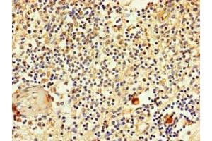 Immunohistochemistry of paraffin-embedded human spleen tissue using ABIN7170119 at dilution of 1:100 (SLC2A3 antibody  (AA 205-269))