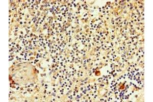 Immunohistochemistry of paraffin-embedded human spleen tissue using ABIN7170119 at dilution of 1:100 (SLC2A3 antibody  (AA 205-269))