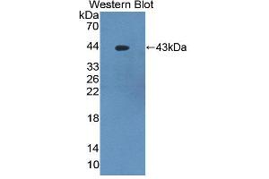 Figure. (PKC delta antibody  (AA 330-672))