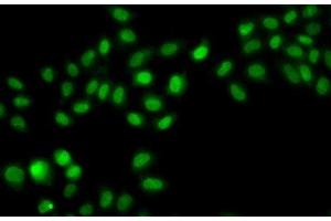 Immunofluorescence analysis of A549 cells using SULT2B1 Polyclonal Antibody