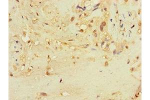 Immunohistochemistry of paraffin-embedded human placenta tissue using ABIN7171870 at dilution of 1:100 (TSPAN32 antibody  (AA 111-202))