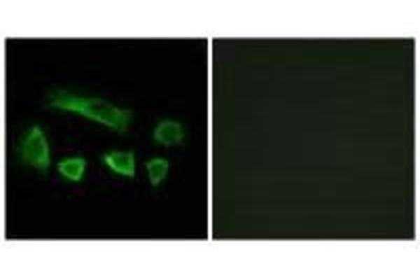NT5C1B antibody