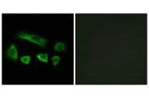 Immunofluorescence analysis of A549 cells, using NT5C1B antibody. (NT5C1B antibody)
