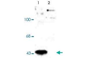 Western blot of human T-47D cells showing specific immunolabeling of the ~45k MAP2K1 (Control).