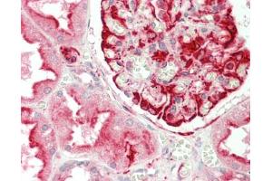 Human Kidney: Formalin-Fixed, Paraffin-Embedded (FFPE)