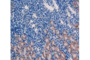 Used in DAB staining on fromalin fixed paraffin- embedded kidney tissue (ATM antibody  (AA 486-742))