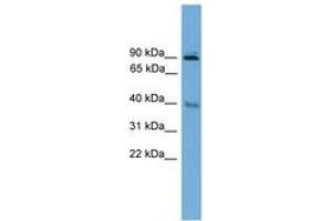 Image no. 1 for anti-L(3)mbt-Like 1 (L3MBTL1) (AA 221-270) antibody (ABIN6744661) (L3MBTL1 antibody  (AA 221-270))