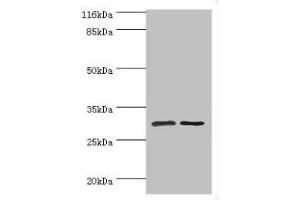 Western blot All lanes: SRPRB antibody at 2 μg/mL Lane 1: HepG2 whole cell lysate Lane 2: Hela whole cell lysate Secondary Goat polyclonal to rabbit IgG at 1/10000 dilution Predicted band size: 30 kDa Observed band size: 30 kDa (SRPRB antibody  (AA 58-271))