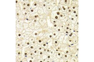 Immunohistochemistry of paraffin-embedded human liver injury using DDB1 Antibody. (DDB1 antibody)