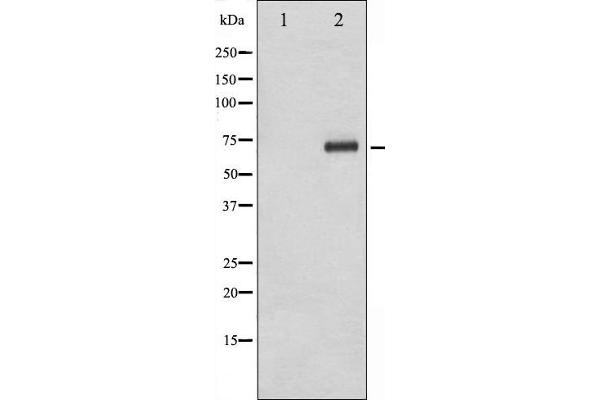 RPS6KB1 antibody  (pThr229)