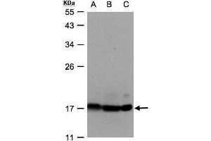 WB Image Sample(30 ug whole cell lysate) A:Hep G2, B:MOLT4, C:Raji, 12% SDS PAGE antibody diluted at 1:500 (ATP Synthase delta (Center) antibody)