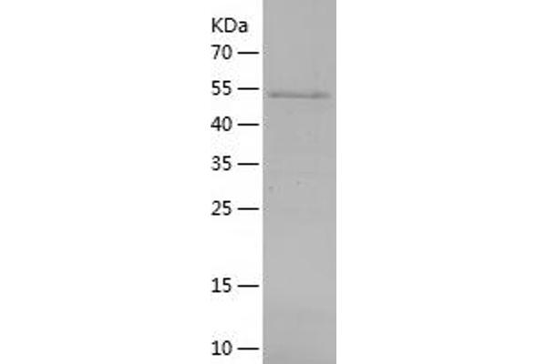 ANGPTL6 Protein (AA 21-470) (His tag)
