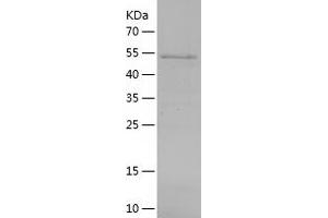 Western Blotting (WB) image for Angiopoietin-Like 6 (ANGPTL6) (AA 21-470) protein (His tag) (ABIN7121832) (ANGPTL6 Protein (AA 21-470) (His tag))
