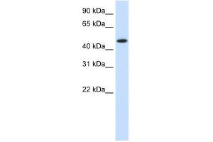 WB Suggested Anti-HSP90B1 Antibody Titration:  1. (GRP94 antibody  (N-Term))