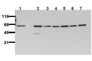 Western Blotting (WB) image for anti-V-Akt Murine Thymoma Viral Oncogene Homolog 2 (AKT2) antibody (ABIN126856) (AKT2 antibody)