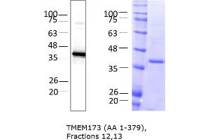 Western Blotting (WB) image for Transmembrane Protein 173 (TMEM173) (AA 1-379) protein (rho-1D4 tag) (ABIN3095714)