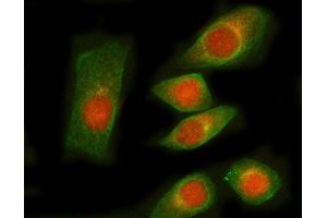 IF analysis of RNGTT and Tubulin beta using anti-RNGTT antibody (ABIN7599723) and anti-Tubulin beta antibody (ABIN7602744). (RNGTT antibody  (AA 11-438))