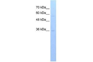 WB Suggested Anti-RFPL3 Antibody Titration:  0. (RFPL3 antibody  (C-Term))
