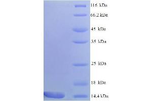 Chemokine (C-C Motif) Ligand 9 (Ccl9) (AA 22-114), (partial) protein (His tag)
