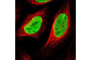 Immunofluorescent staining of human cell line U-2 OS with HDAC2 polyclonal antibody  shows positivity in nucleus. (HDAC2 antibody  (AA 415-488))