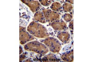 Immunohistochemistry (IHC) image for anti-Aspartate beta-Hydroxylase (ASPH) antibody (ABIN2996945)