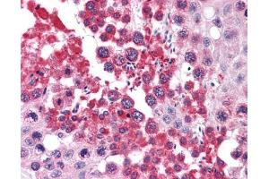 IHC-P Image Immunohistochemical analysis of paraffin-embedded human testis, using RUVBL2, antibody(10 μg/ml). (RUVBL2 antibody  (C-Term))