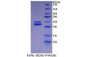 SDS-PAGE (SDS) image for Haptoglobin (HP) (AA 118-281) protein (His tag) (ABIN2121195) (Haptoglobin Protein (HP) (AA 118-281) (His tag))