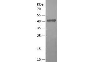Western Blotting (WB) image for Glutamic-Oxaloacetic Transaminase 2, Mitochondrial (Aspartate Aminotransferase 2) (GOT2) (AA 2-413) protein (His tag) (ABIN7123118) (GOT2 Protein (AA 2-413) (His tag))