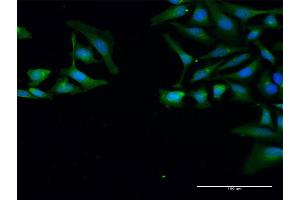 Immunofluorescence of purified MaxPab antibody to SNRPB on HeLa cell. (SNRPB antibody  (AA 1-240))