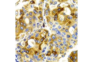 Immunohistochemistry (IHC) image for anti-Cyclin-Dependent Kinase 20 (CDK20) antibody (ABIN3016460) (CCRK antibody)