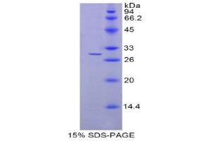 SDS-PAGE (SDS) image for N-Acylethanolamine Acid Amidase (NAAA) (AA 112-359) protein (His tag) (ABIN1877457)