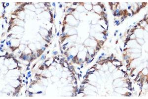 Immunohistochemistry of paraffin-embedded Human colon using HSPA1A Monoclonal Antibody at dilution of 1:100 (40x lens). (HSP70 1A antibody)
