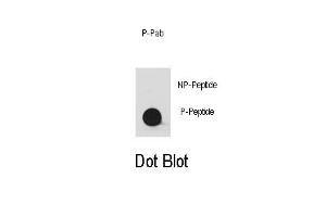 Dot blot analysis of anti-Phospho-YES1-/Phospho-SRC- Antibody (ABIN389661 and ABIN2850452) on nitrocellulose membrane. (YES1/SRC (pTyr530) antibody)