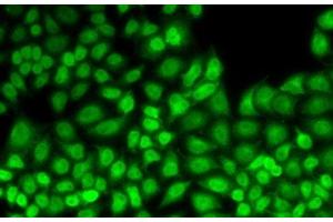 Immunofluorescence analysis of HeLa cells using JUNB Polyclonal Antibody (JunB antibody)