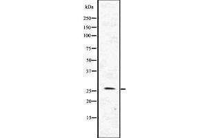 Western blot analysis of FLT3LG using HepG2 whole  lysates. (FLT3LG antibody  (C-Term))