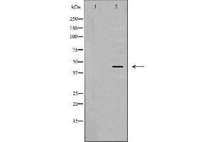 Western blot analysis of extracts of TPH1 , using CHI3L1 antibody.