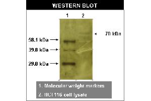 Western blot using RYK antibody   on HCT116 cell lysates.
