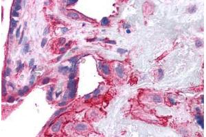 Human Placenta: Formalin-Fixed, Paraffin-Embedded (FFPE) (SNAP23 antibody  (AA 1-132))