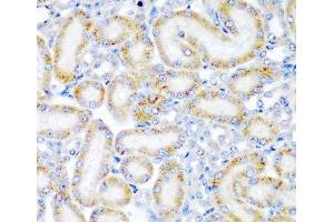 Immunohistochemistry of paraffin-embedded Rat kidney using WRB Polyclonal Antibody at dilution of 1:200 (40x lens).