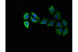 Immunofluorescent analysis of A549 cells using ABIN7142496 at dilution of 1:100 and Alexa Fluor 488-congugated AffiniPure Goat Anti-Rabbit IgG(H+L) (RPS15 antibody  (AA 63-137))