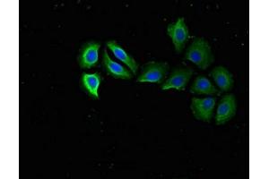 Immunofluorescent analysis of A549 cells using ABIN7142496 at dilution of 1:100 and Alexa Fluor 488-congugated AffiniPure Goat Anti-Rabbit IgG(H+L)