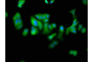 Immunofluorescence staining of MCF-7 cells with ABIN7150910 at 1:100, counter-stained with DAPI. (DTNBP1 antibody  (AA 258-351))