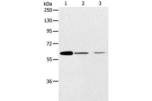Western Blot analysis of NIH/3T3 and SKOV3 cell, Human ovarian cancer tissue using ABCE1 Polyclonal Antibody at dilution of 1:450 (ABCE1 antibody)
