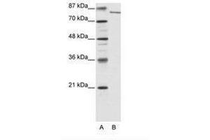 Image no. 2 for anti-Lysine (K)-Specific Demethylase 2A (KDM2A) (N-Term) antibody (ABIN6736177) (KDM2A antibody  (N-Term))