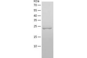 Western Blotting (WB) image for Crystallin, beta A4 (CRYbA4) (AA 1-196) protein (His tag) (ABIN7286460) (CRYbA4 Protein (AA 1-196) (His tag))