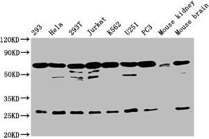 Western Blot Positive WB detected in: 293 whole cell lysate, Hela whole cell lysate, 293T whole cell lysate, Jurkat whole cell lysate, K562 whole cell lysate, U251 whole cell lysate, PC-3 whole cell lysate, Mouse kidney tissue, Mouse brain tissue All lanes: ARIH2 antibody at 1:2000 Secondary Goat polyclonal to rabbit IgG at 1/50000 dilution Predicted band size: 58 kDa Observed band size: 68 kDa