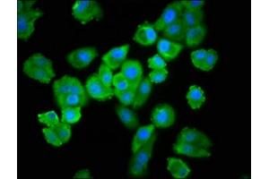 Immunofluorescence staining of HepG2 cells with ABIN7174468 at 1:100, counter-stained with DAPI. (UBE2L3 antibody  (AA 1-154))