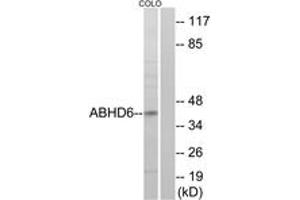 Western blot analysis of extracts from COLO cells, using ABHD6 Antibody. (ABHD6 antibody  (AA 231-280))